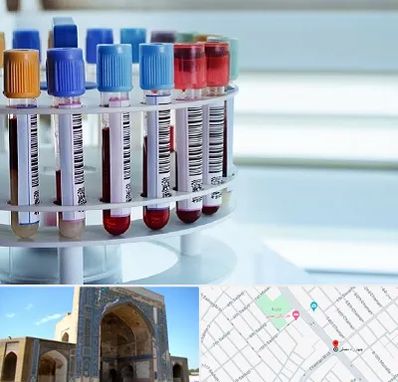 آزمایشگاه ژنتیک در مصلی مشهد