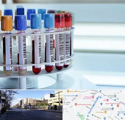 آزمایشگاه ژنتیک در خیابان ملاصدرا شیراز