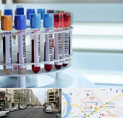 آزمایشگاه ژنتیک در زیتون کارمندی اهواز