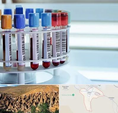 آزمایشگاه ژنتیک در اسکو