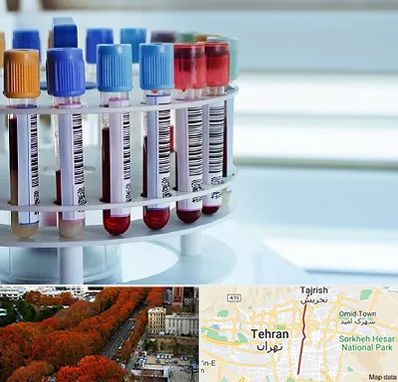 آزمایشگاه ژنتیک در ولیعصر