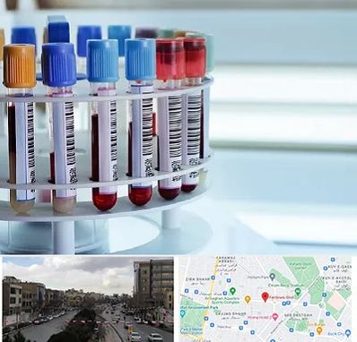 آزمایشگاه ژنتیک در بلوار فردوسی مشهد