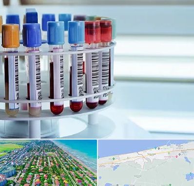 آزمایشگاه ژنتیک در فریدونکنار