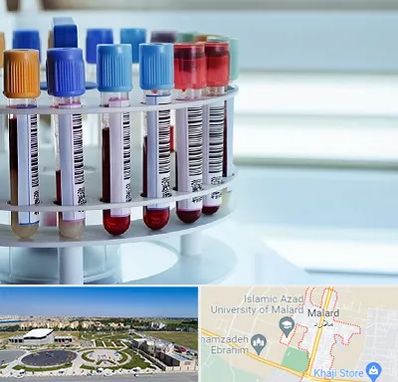 آزمایشگاه ژنتیک در ملارد