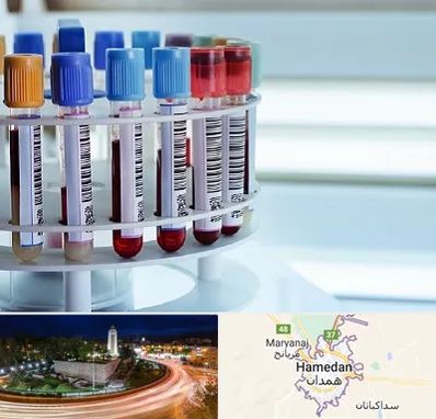 آزمایشگاه ژنتیک در همدان