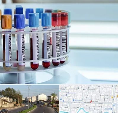 آزمایشگاه ژنتیک در ضیابری رشت