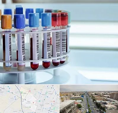 آزمایشگاه ژنتیک در حصارک کرج