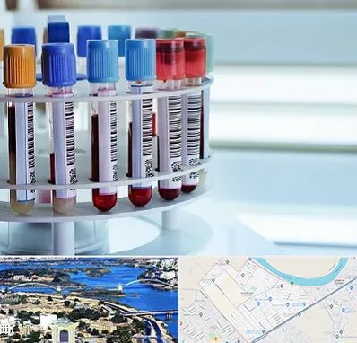 آزمایشگاه ژنتیک در کوروش اهواز