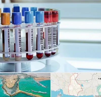 آزمایشگاه ژنتیک در سیستان و بلوچستان