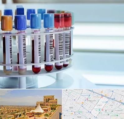 آزمایشگاه ژنتیک در هاشمیه مشهد