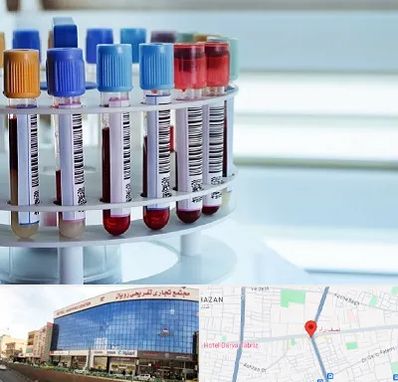 آزمایشگاه ژنتیک در نصف راه تبریز