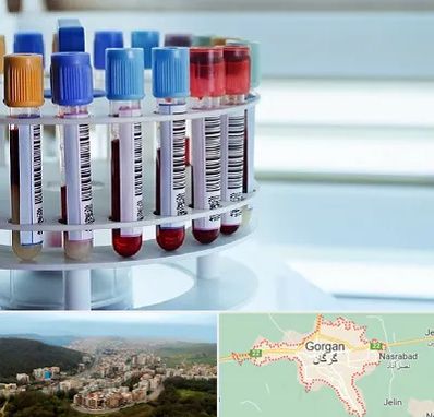 آزمایشگاه ژنتیک در گرگان