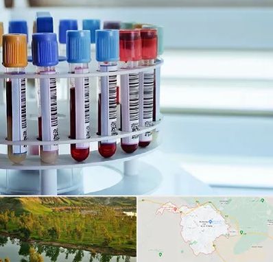 آزمایشگاه ژنتیک در بهبهان