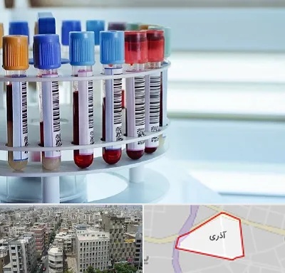 آزمایشگاه ژنتیک در آذری