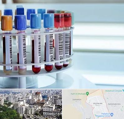 آزمایشگاه ژنتیک در ولنجک