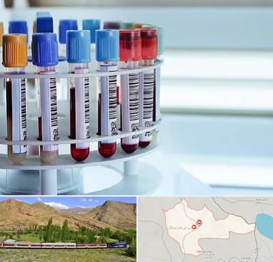 آزمایشگاه ژنتیک در خاش