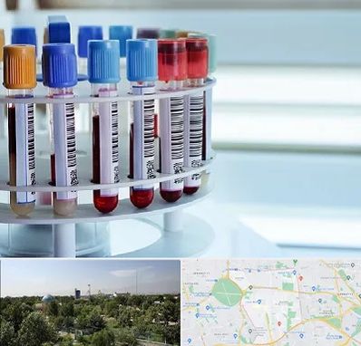 آزمایشگاه ژنتیک در منطقه 16 تهران