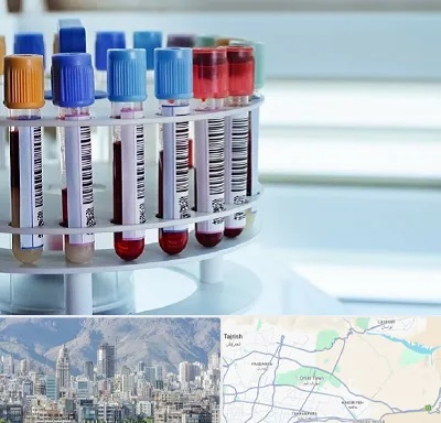 آزمایشگاه ژنتیک در شمال شرق تهران