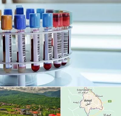 آزمایشگاه ژنتیک در آمل