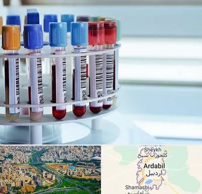 آزمایشگاه ژنتیک در اردبیل