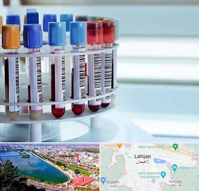 آزمایشگاه ژنتیک در لاهیجان