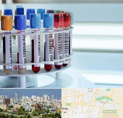 آزمایشگاه ژنتیک در شرق تهران