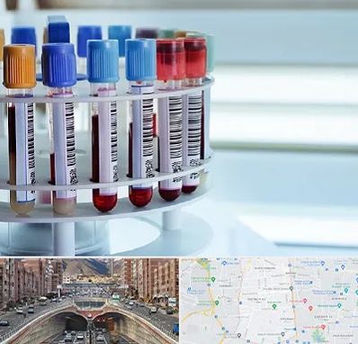 آزمایشگاه ژنتیک در منطقه 10 تهران