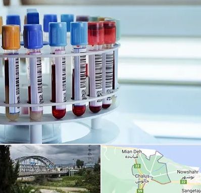 آزمایشگاه ژنتیک در چالوس