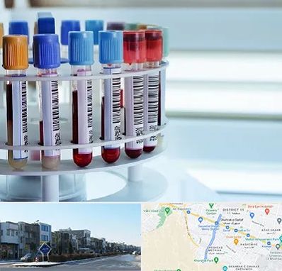 آزمایشگاه ژنتیک در شریعتی مشهد