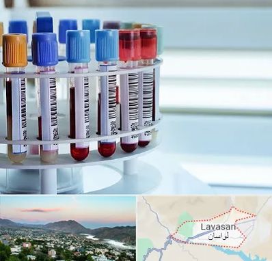 آزمایشگاه ژنتیک در لواسان