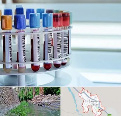 آزمایشگاه ژنتیک در سراوان