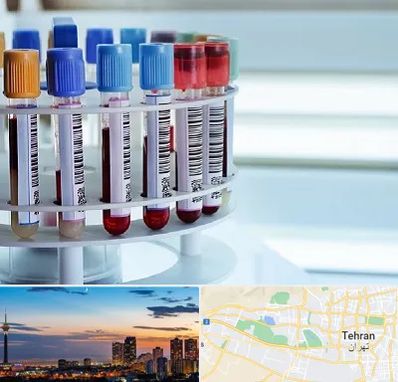 آزمایشگاه ژنتیک در غرب تهران