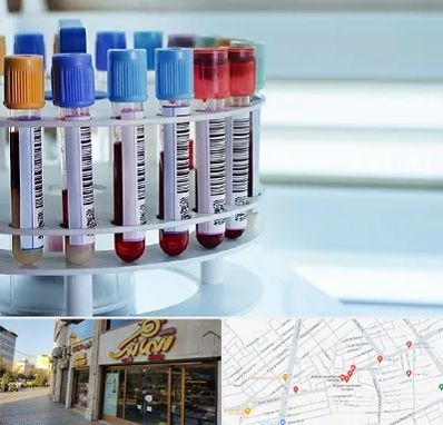 آزمایشگاه ژنتیک در عطاران قم