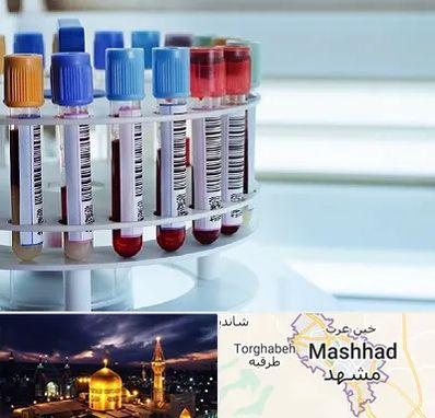 آزمایشگاه ژنتیک در مشهد