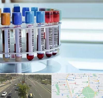 آزمایشگاه ژنتیک در منطقه 17 تهران