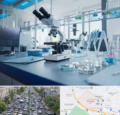 آزمایشگاه تیروئید در گلشهر کرج