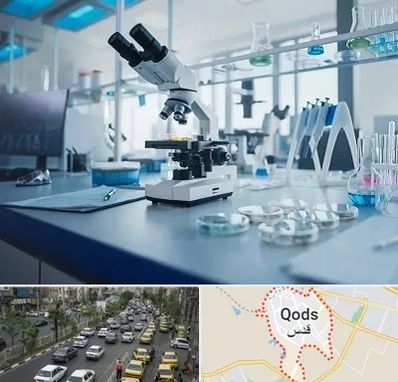 آزمایشگاه تیروئید در شهر قدس