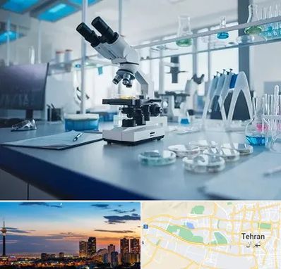 آزمایشگاه تیروئید در غرب تهران