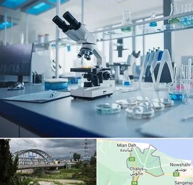 آزمایشگاه تیروئید در چالوس