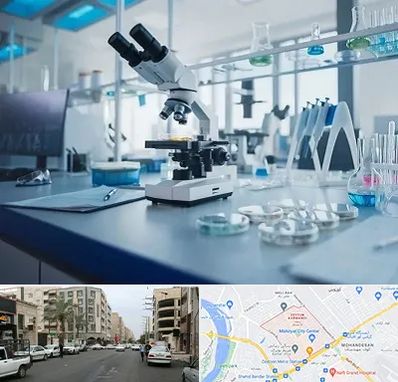 آزمایشگاه تیروئید در زیتون کارمندی اهواز