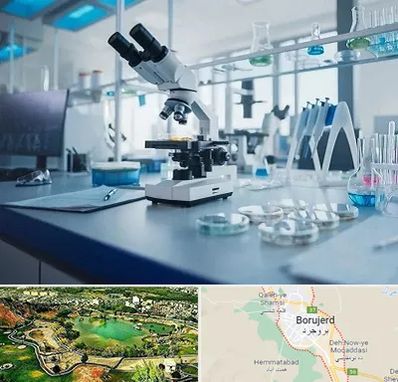 آزمایشگاه تیروئید در بروجرد