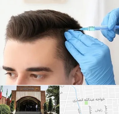 مزوتراپی مو در خواجه عبدالله