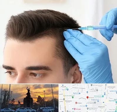 مزوتراپی مو در میدان حر