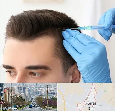 مزوتراپی مو در گوهردشت