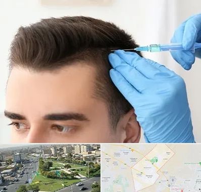 مزوتراپی مو در کمال شهر کرج