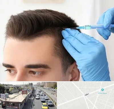 مزوتراپی مو در خیابان دماوند