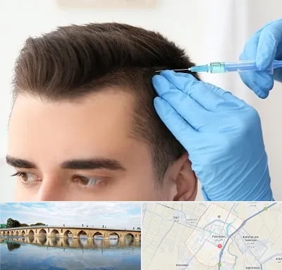 مزوتراپی مو در فلاورجان