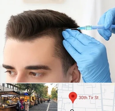 مزوتراپی مو در سی تیر