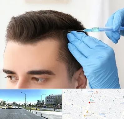 مزوتراپی مو در بلوار کلاهدوز مشهد