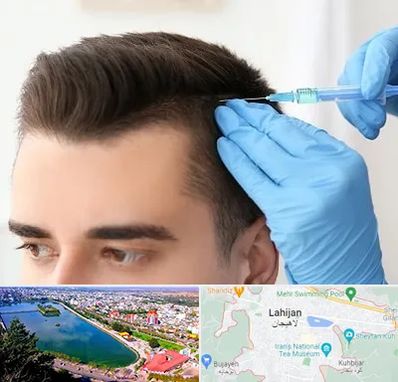 مزوتراپی مو در لاهیجان